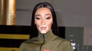 Winnie Harlow